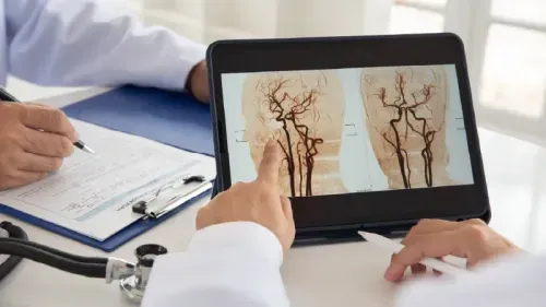 What is the Cost of Angiography in Lucknow